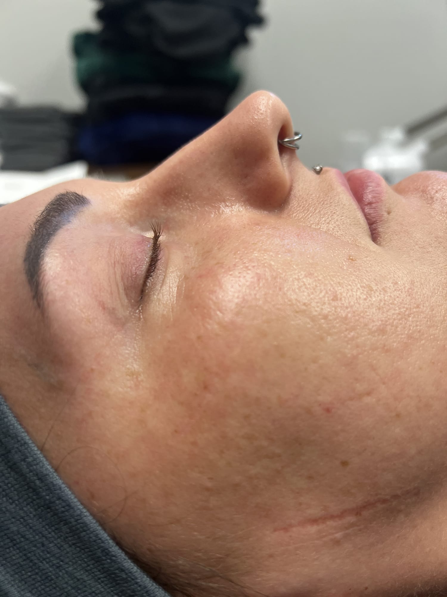 Before Image: Lash Lift - right-side