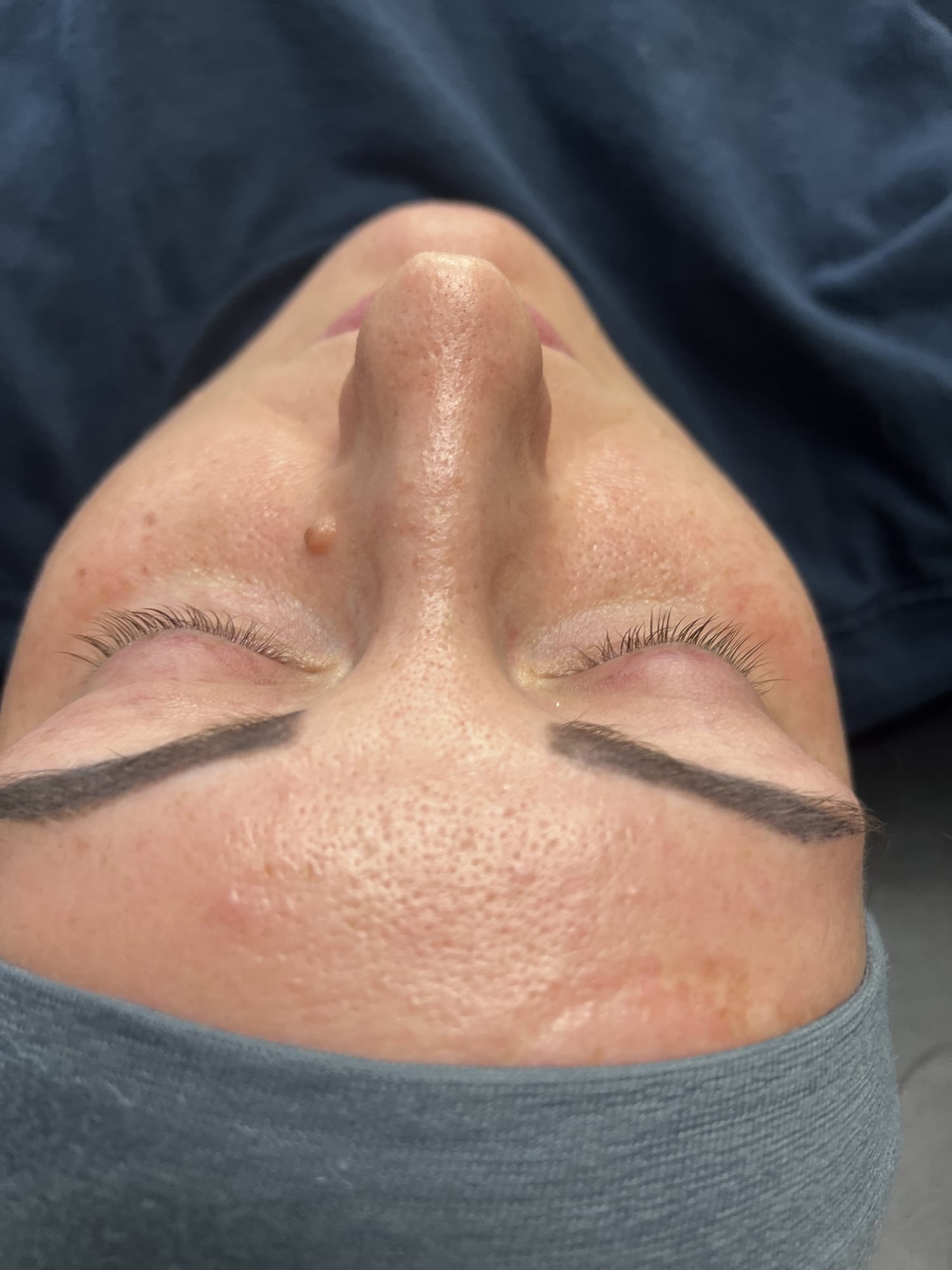 Before Image: Lash Lift - front